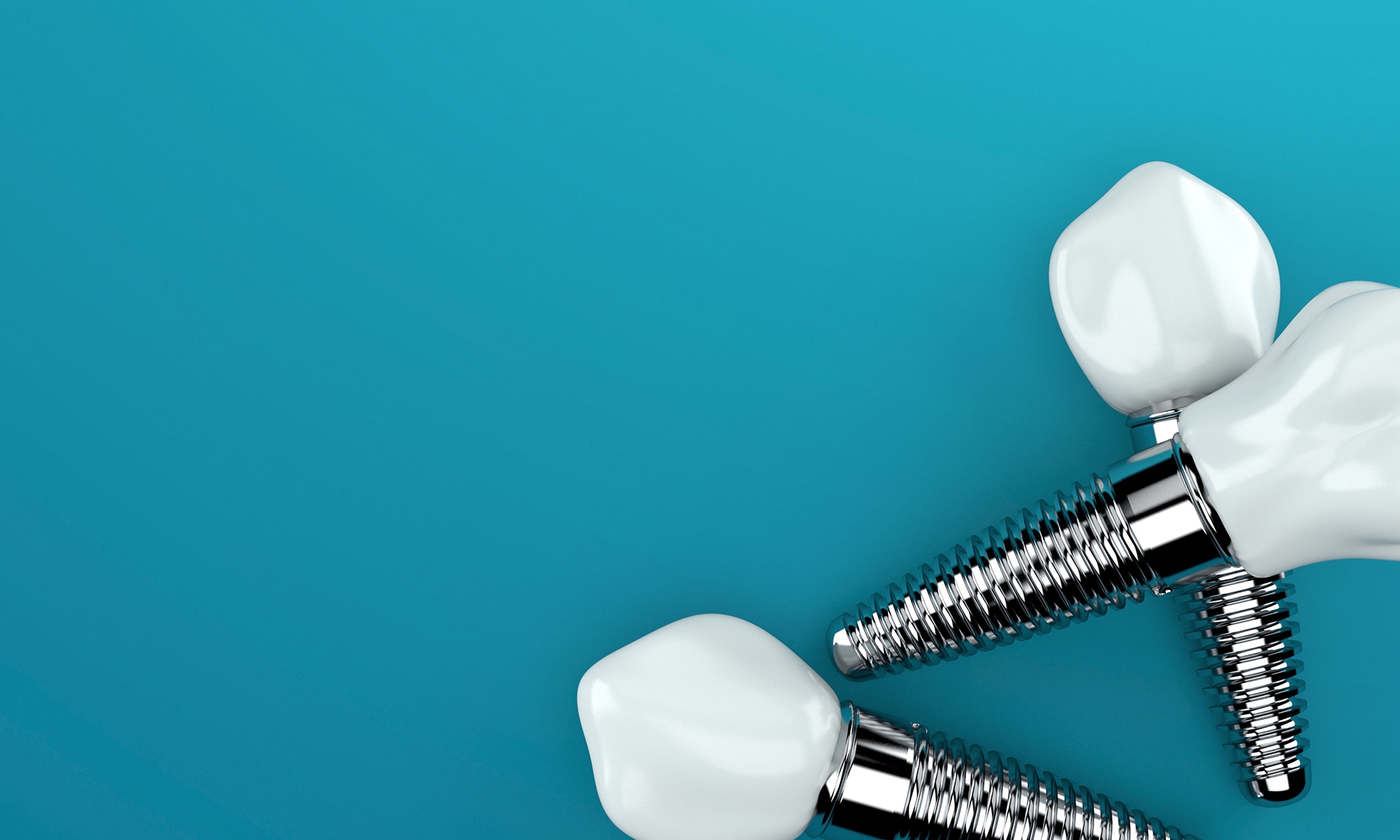 https://www.colinadental.com/services/dental-implants/